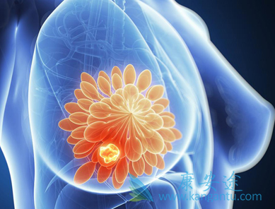 推瑞米芬 推瑞米芬