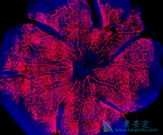 托瑞米芬 托瑞米芬