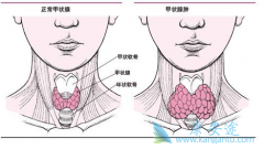 ���ڼ�״�ٰ�֢״���׷������������Ԥ����֢