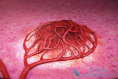 ���ڸΰ����߳Կ��ΰ�ҩ������(REGORAFENIB)�ܻ���