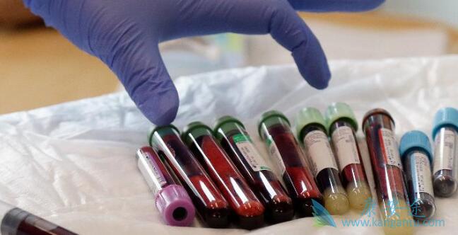 CAR-T细胞疗法 CAR-T细胞疗法