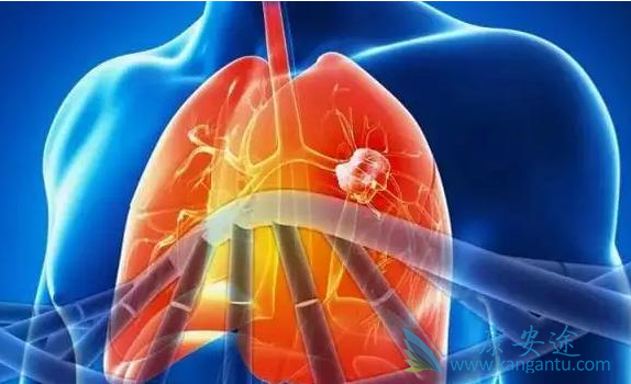 小细胞肺癌 小细胞肺癌