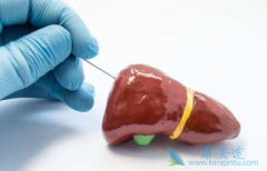 �Ҹ���ҩ��ŵ��Τ����(TAF)���ҹ����ٴ������Ѿ���չ