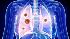 �ΰ����ڿ����κ��𣿷ΰ����ڵ����Ʒ�����ôѡ��