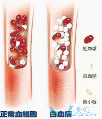 ӡ�ȸ�����