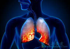 ���Ʒΰ��۰��İ���ҩ����Щ��PD-1�����Ʒ����κ÷��۰���