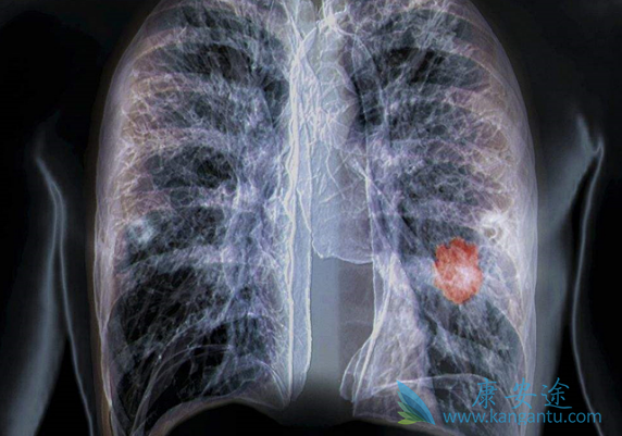 ̵�д�Ѫ����ô����