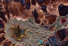 �ط��Է���ά����ô���ƣ�������ͪ���Ʒ���ά��Ч������