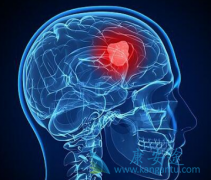 ������֢״����Щ���������ѡ�����������Ʒ�����