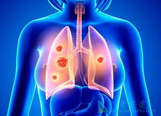 �ΰ��������κõ���