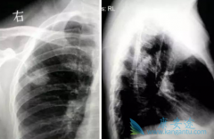 �ΰ����߷���ӡ������ɳ(GEFINAT)��Ч����Ҫ�Զ�ã�