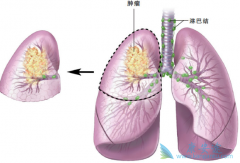 �׹��ټ��غͼ�������(GEFINAT)���Ӧ���е���ͨ·������