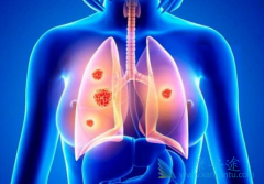 �ΰ�����һ�߷��ö�������(GRLONAT)����ֽ�չ����ô��