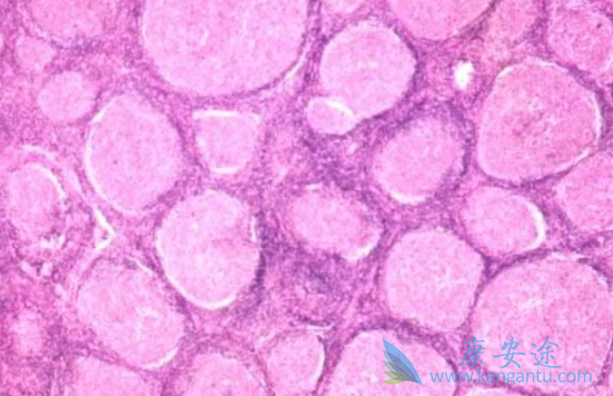 来那度胺 来那度胺