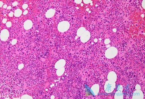 尼洛替尼 尼洛替尼