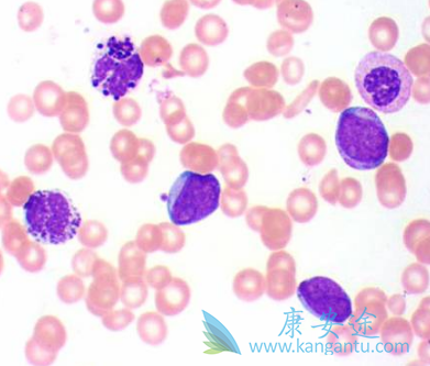 尼洛替尼 尼洛替尼