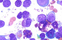 ���������ѵĻ���ֻ�ܽ���ϣ��(Nilotinib)����1���ƻ�����з���