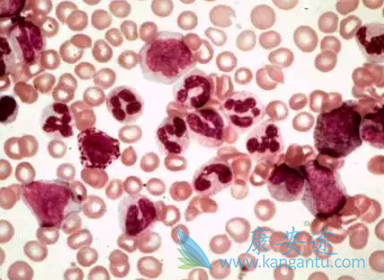 尼洛替尼 尼洛替尼