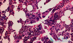 ʲô�ǹ�����ά����«���������ƹ�����ά����ʲô���ƣ�