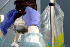 CAR-Tϸ�������Ʒ���ȽϷŻ��ƵȰ�֢�Ʒ���ʲô�ص�