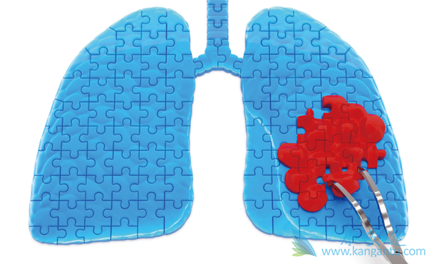 阿法替尼 阿法替尼