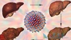 ��άĪ˾(Afinitor)���ܸ������ڸΰ����ߵ��޽�չ������