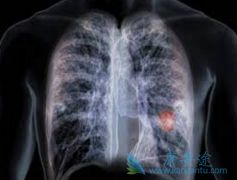 �����ΰ�ҩ�￭����/�������������ڷΰ����ߵ���ѡ��