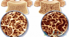 �෢�Թ�����ҩ������(Velcade)�����ƹ������ɵ�Ǳ��