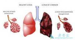 �ΰ����߷��ð�ϣ����(OSIMERTINIB)��Ӱ�컳�кͲ�����