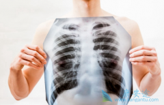 �ΰ��������ѡ������ɳ(Iressa)����ҩʱ��