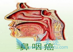 ���ʰ����ƺ󸴷��Ļ��߻����ڲ���ͬ���Ż�����