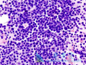 �����׵�