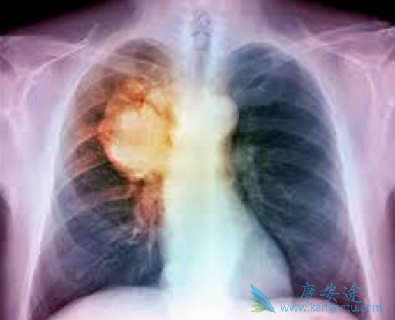 阿法替尼 阿法替尼