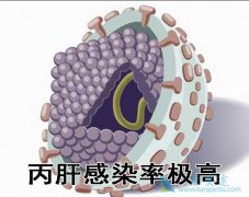 HCV��Ⱦ�������ͷ�������������ķ���Ҳ������