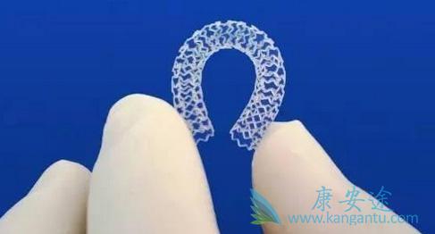 心脏支架 心脏支架