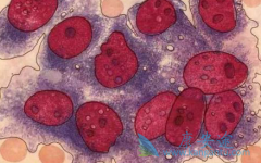 �Ҹ���ҩ�ָ���(Novaferon)�ĸ���������Щ