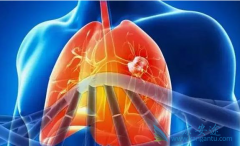 �ΰ���ת�Ƶ����Ʒ���������ԭ��