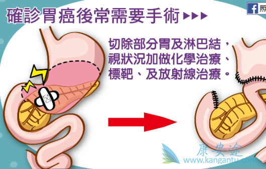 θ��������