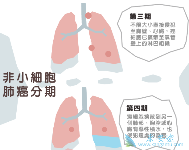 ��Сϸ���ΰ�