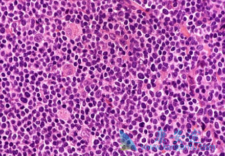 依鲁替尼 依鲁替尼