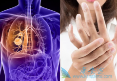 ���߷��ð�������(GILOTRIF)�ڼ�Ҫ��ʱע��Ƥ���仯