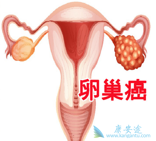 奥拉帕尼 奥拉帕尼