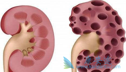 阿西替尼 阿西替尼