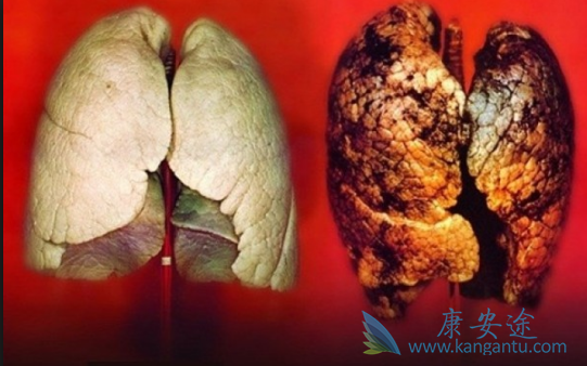 曲美替尼 曲美替尼