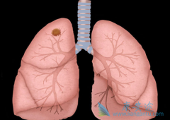 ���˷�����ɳ/�������ỹ��Ը���������Ӱ��