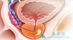 ǰ���ٰ�ҩ�ﰢ������(Zytiga)�м����汾���ĸ��Լ۱ȸߣ�