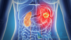 ���߷�����̹/�����������ɫ��������ô����