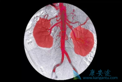 ��������(Cabozantinib)���п���ʵ������ת�Ƶ�����