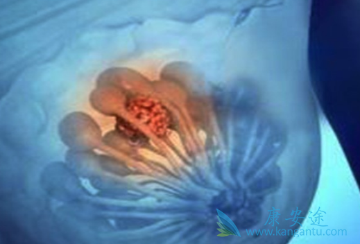 帕博西林 帕博西林