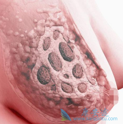 帕博西林 帕博西林